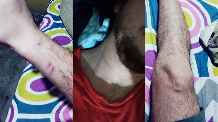 Photos show Henríquez Serrano's injuries after being arrested by immigration agents.