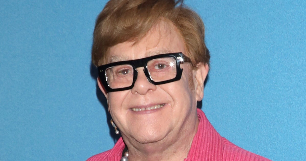 Elton John Shows Off Bedazzled Kneecaps He Had Made Into Jewellery After Surgery