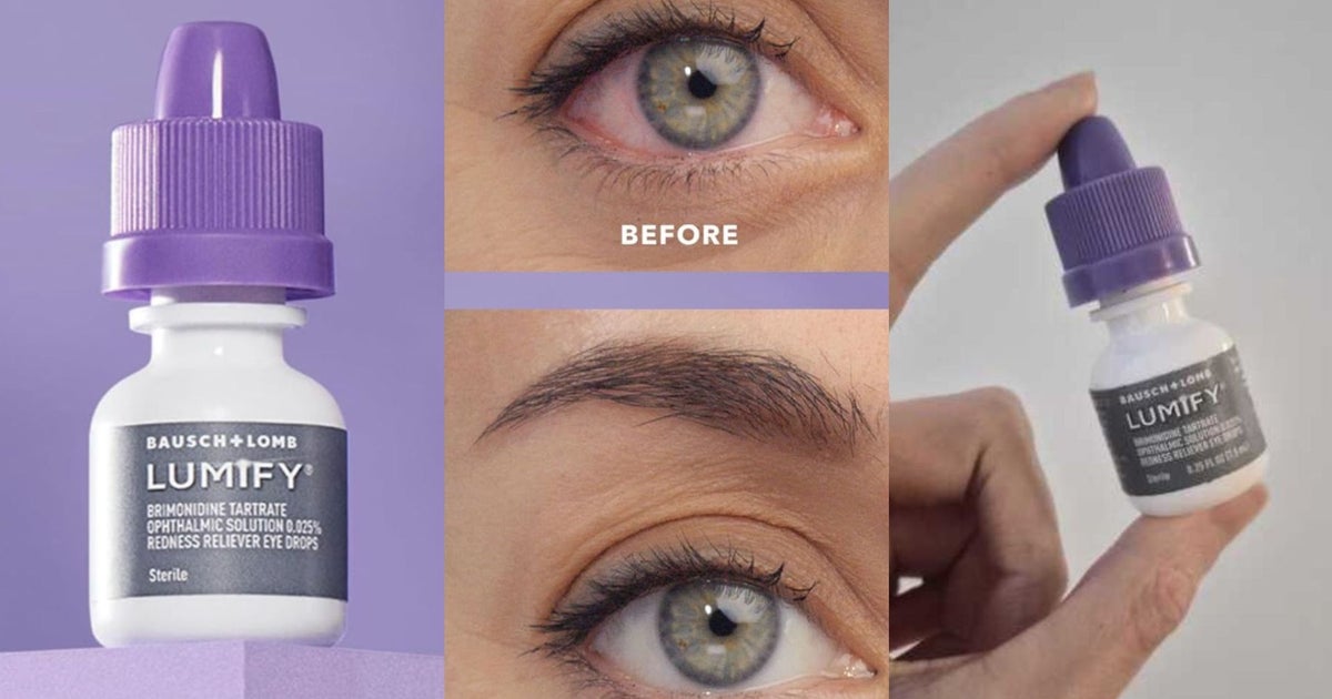 Eye Doctors Say Why Lumify Whitening Drops Work So Well