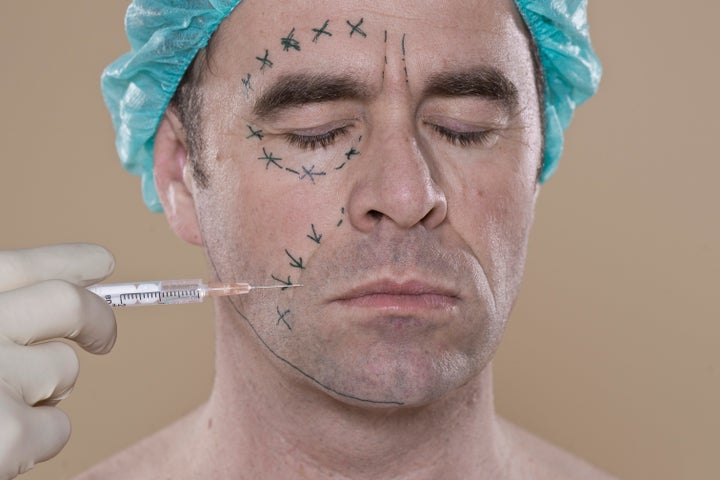 Neuromodulators are often the first procedure men try.