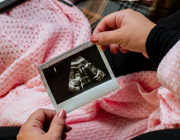 A photo of an ultrasound scan