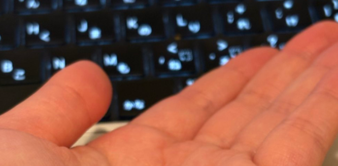 「ついにサイボーグになったか...！？」顔を触っていたらネジが出現⇒「これが頭のネジってやつ？」と反響