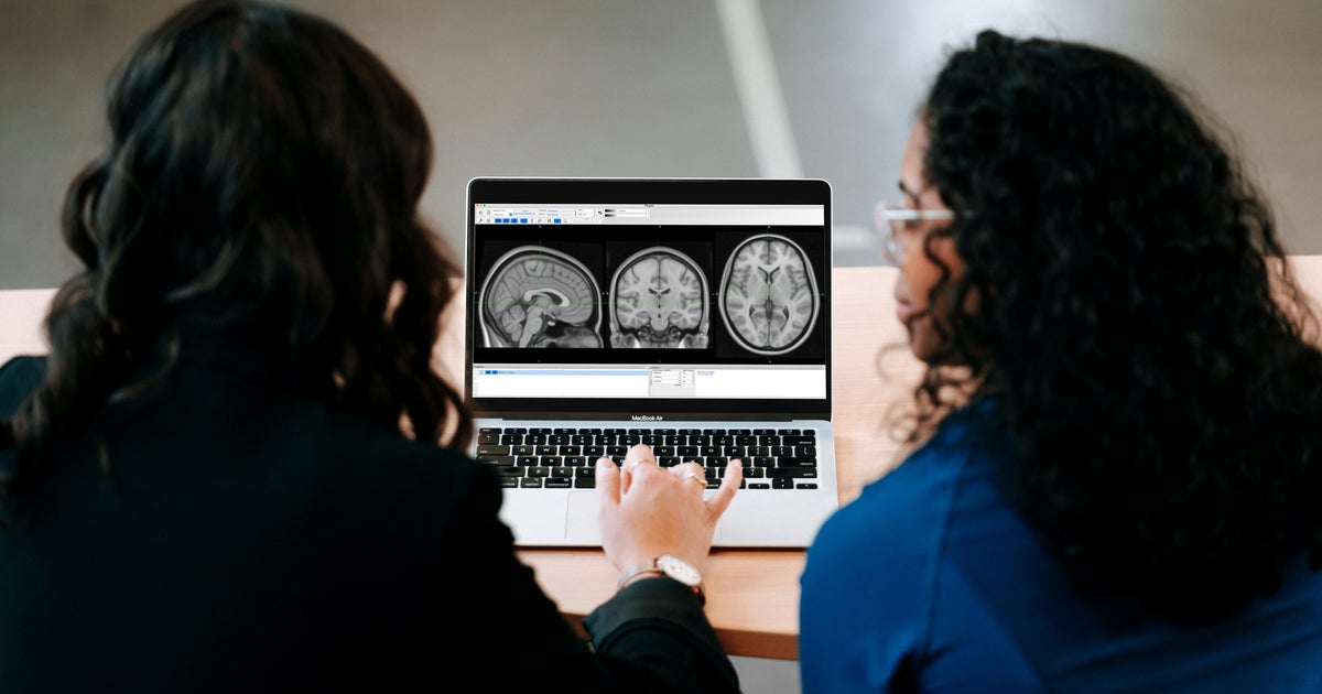 There May Be 3 Different Types Of ADHD