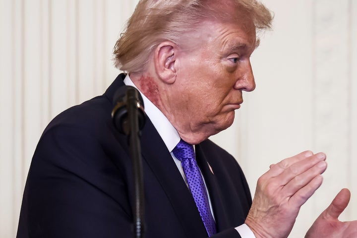 President Donald Trump appeared to have a rash on his neck as he presented the Medal of Honor to three US Army soldiers on Monday.