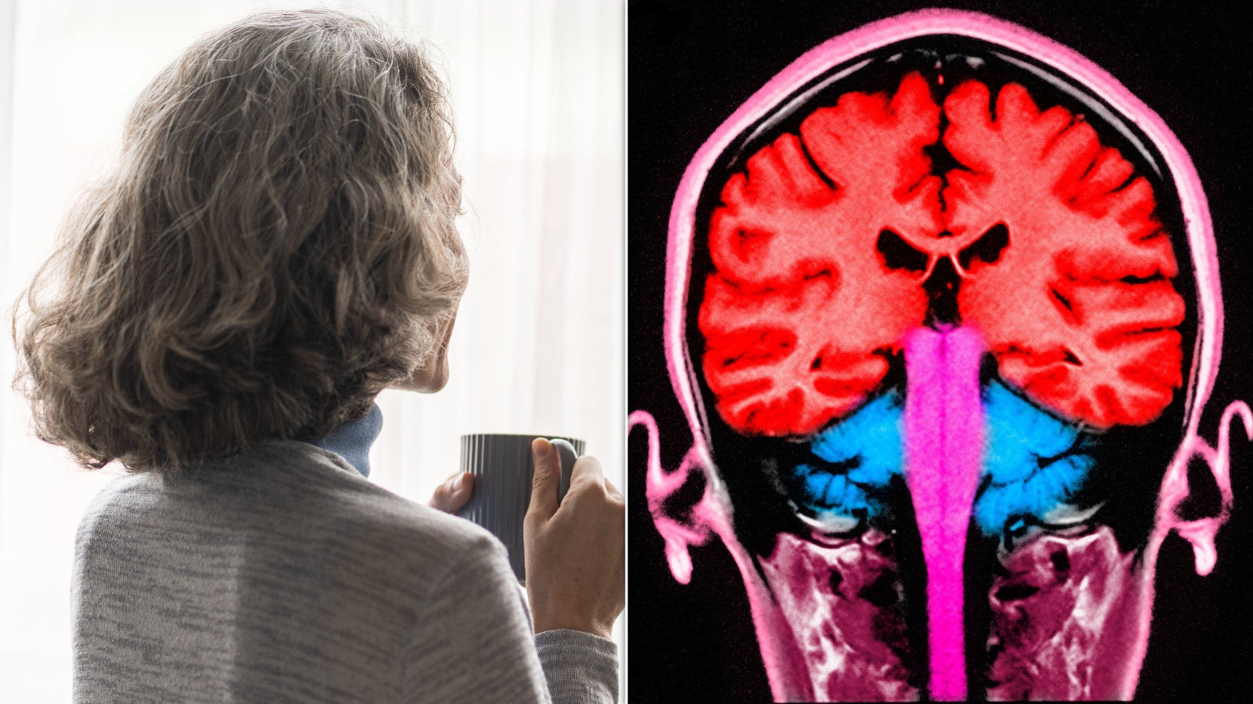 Blood Test Predicts Dementia Risk in Women 25 Years Early, Study Finds