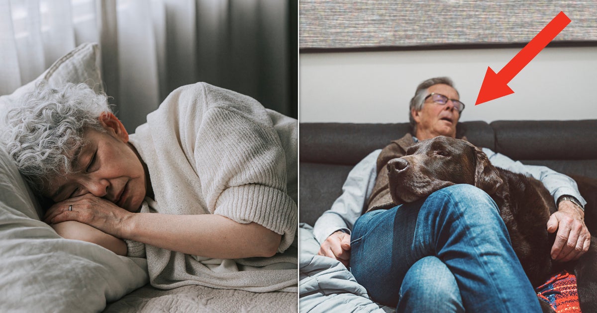 These Sleep Issues Could Be Early Warning Signs Of Dementia These Sleep Issues Could Be Early Warning Signs Of Dementia