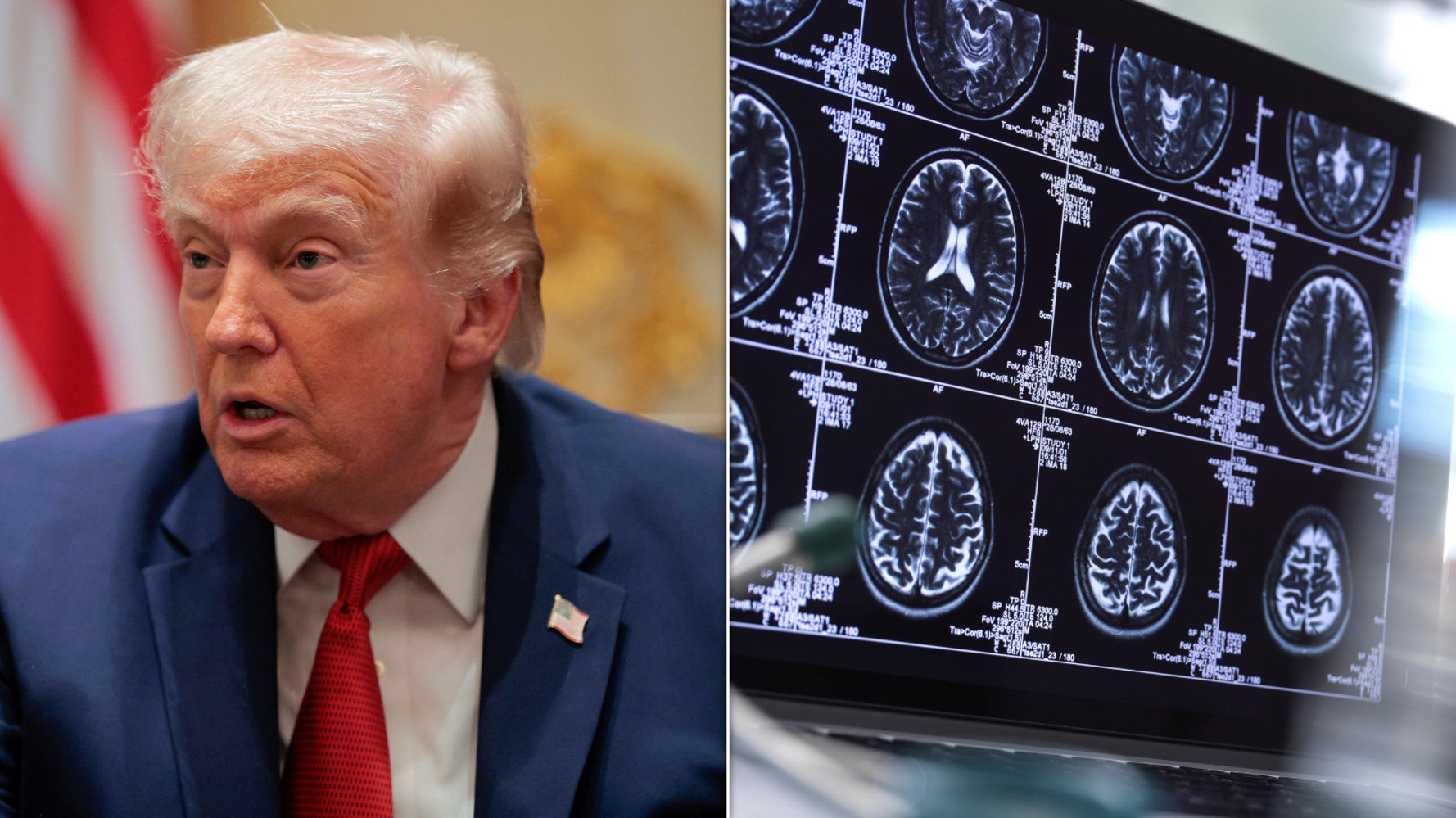 People Are Worried Trump’s War In Iran Could Disrupt Lifesaving Health Tests