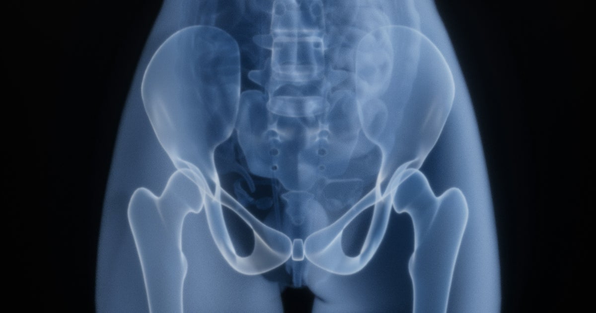 The Best Fruit For Healthy Bones