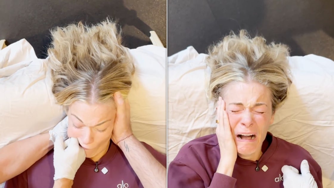 LeAnn Rimes Jaw Release Viral Video & TMJ Relief Explained