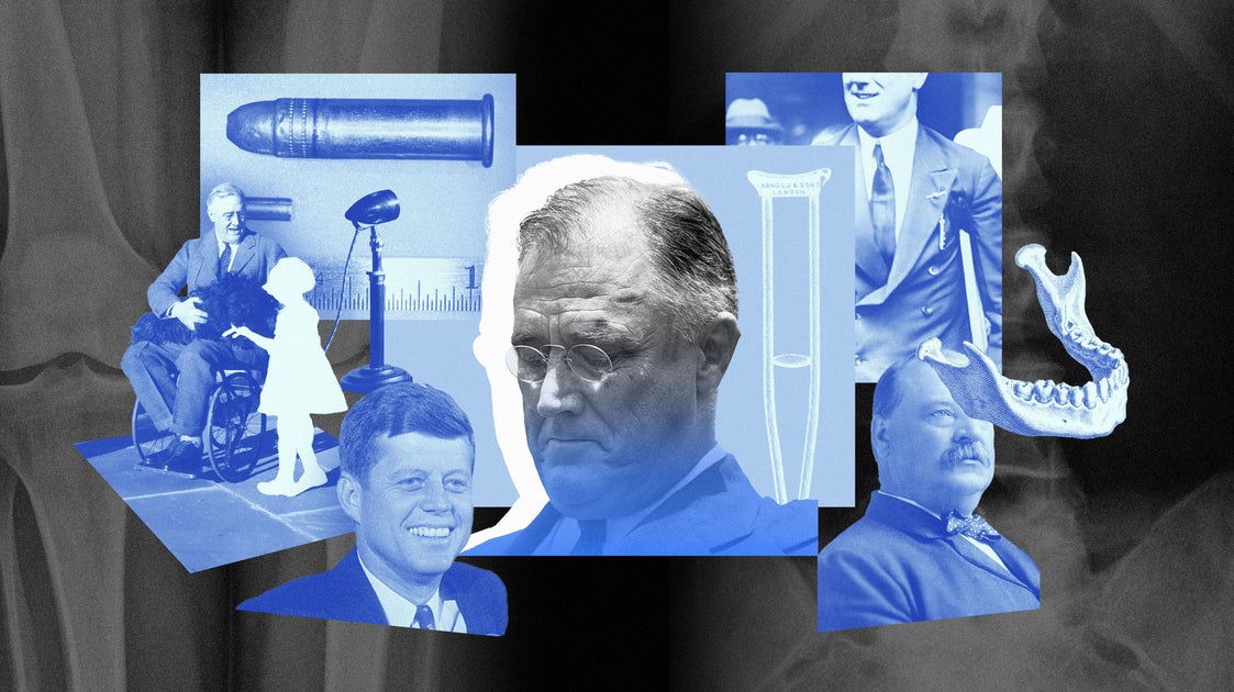 The White House Has Been Hiding Presidents’ Health Issues Longer Than You Think