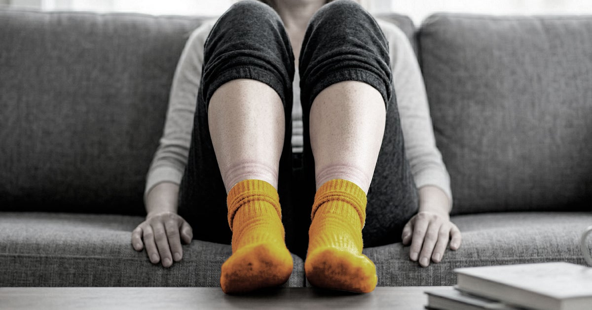 Do Your Socks Leave Marks On Your Legs? Here's What That Means For Your Health.