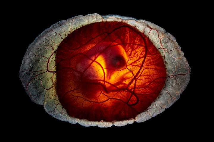 卵の殻の中の様子を可視化