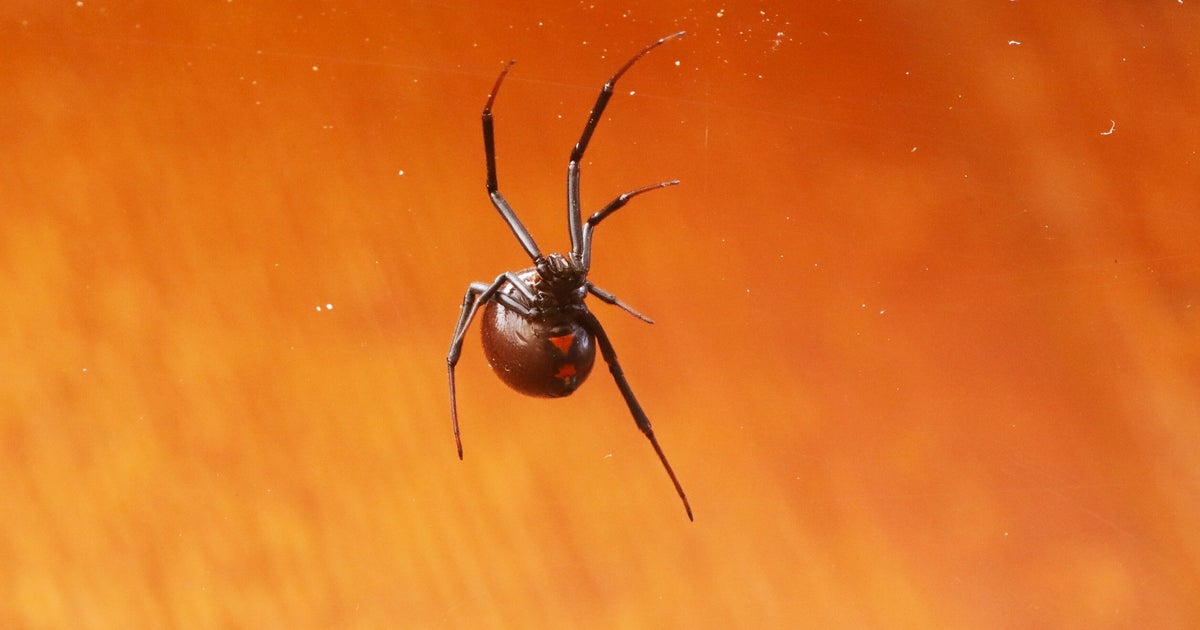 米ミュージシャン、毒グモに咬まれて脚が真っ赤に…⇨入院も翌日ライブ強行、コウモリに咬まれた過去も