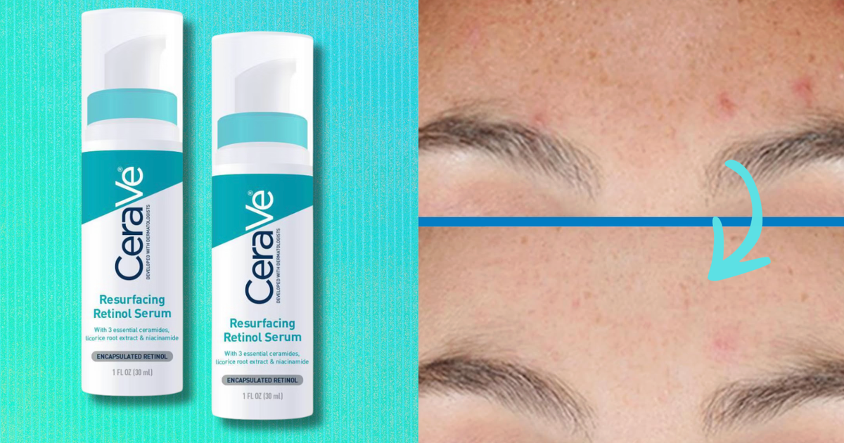 CeraVe’s ‘Life-Changing’ Retinol Serum Is On Sale — And You Can Nab Two For Under $30