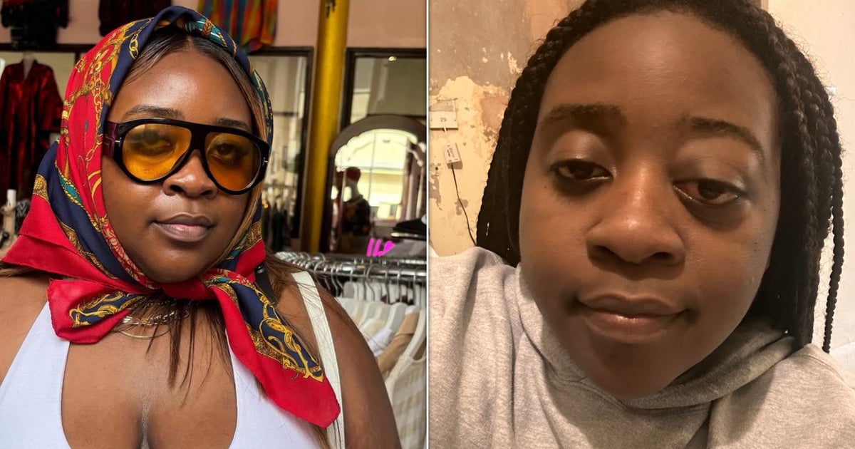 I Had To Save Myself From A Healthcare System That Used Photos Of White People To Dismiss My Pain