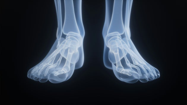 'Heel Walks' Can Make Your Shins Stronger And Improve Your Balance