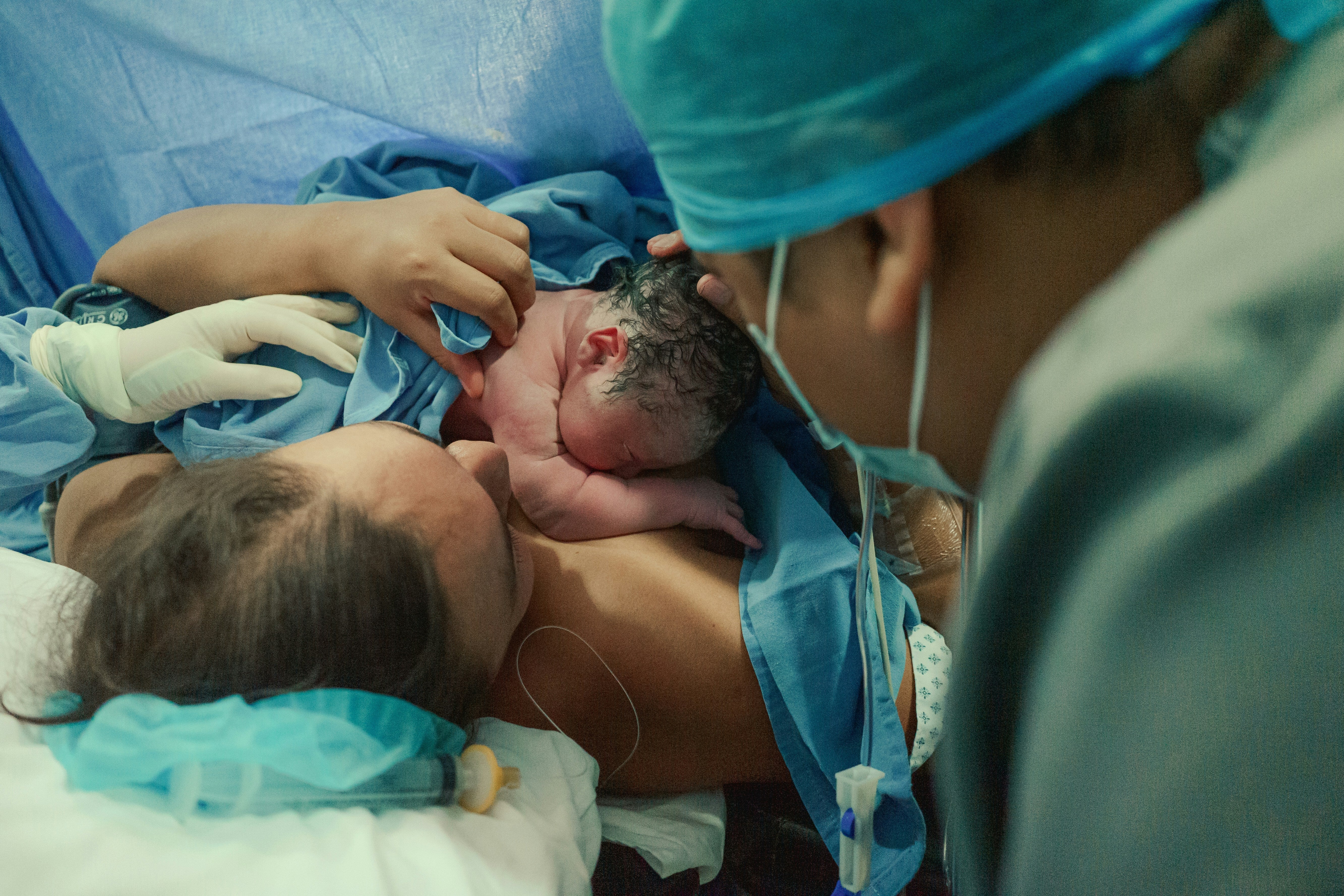 Medical Expert Reveals What Happens Behind The Curtain During A C-Section Birth