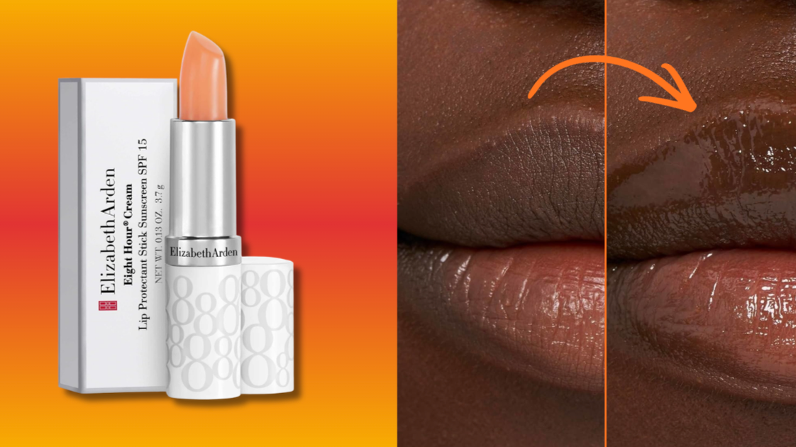 After 30 Years Of Chronically Dry Lips, This Balm Made Them ‘Chap-Free ...