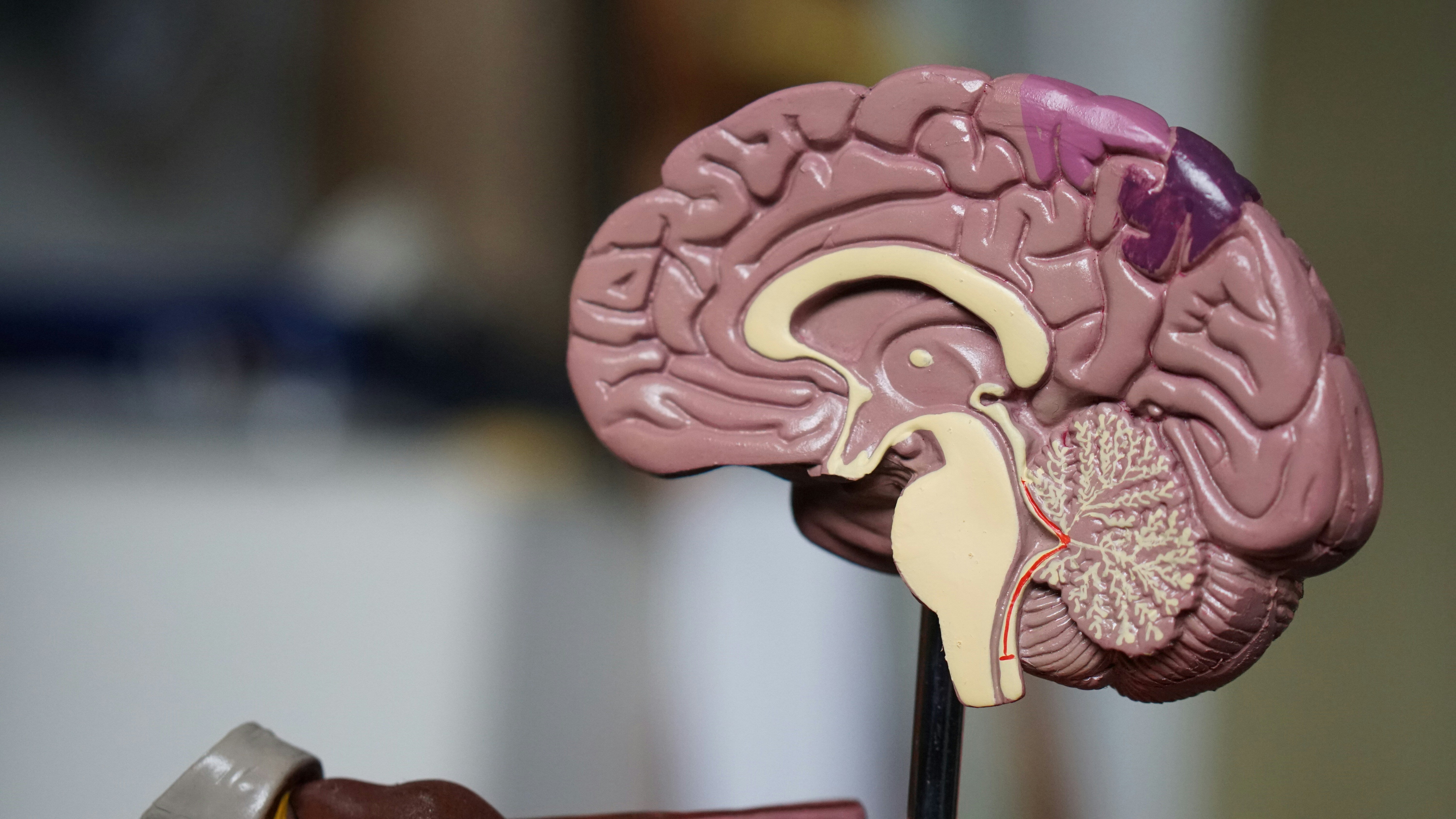 Scientists May Have Found A Cheap Way To Slow Dementia Damage