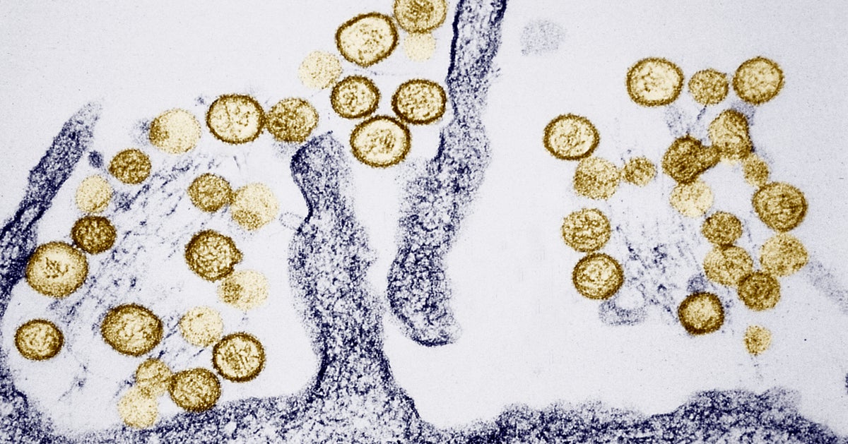 Adult Dies Of Hantavirus In Colorado, State Health Officials Say - HuffPost