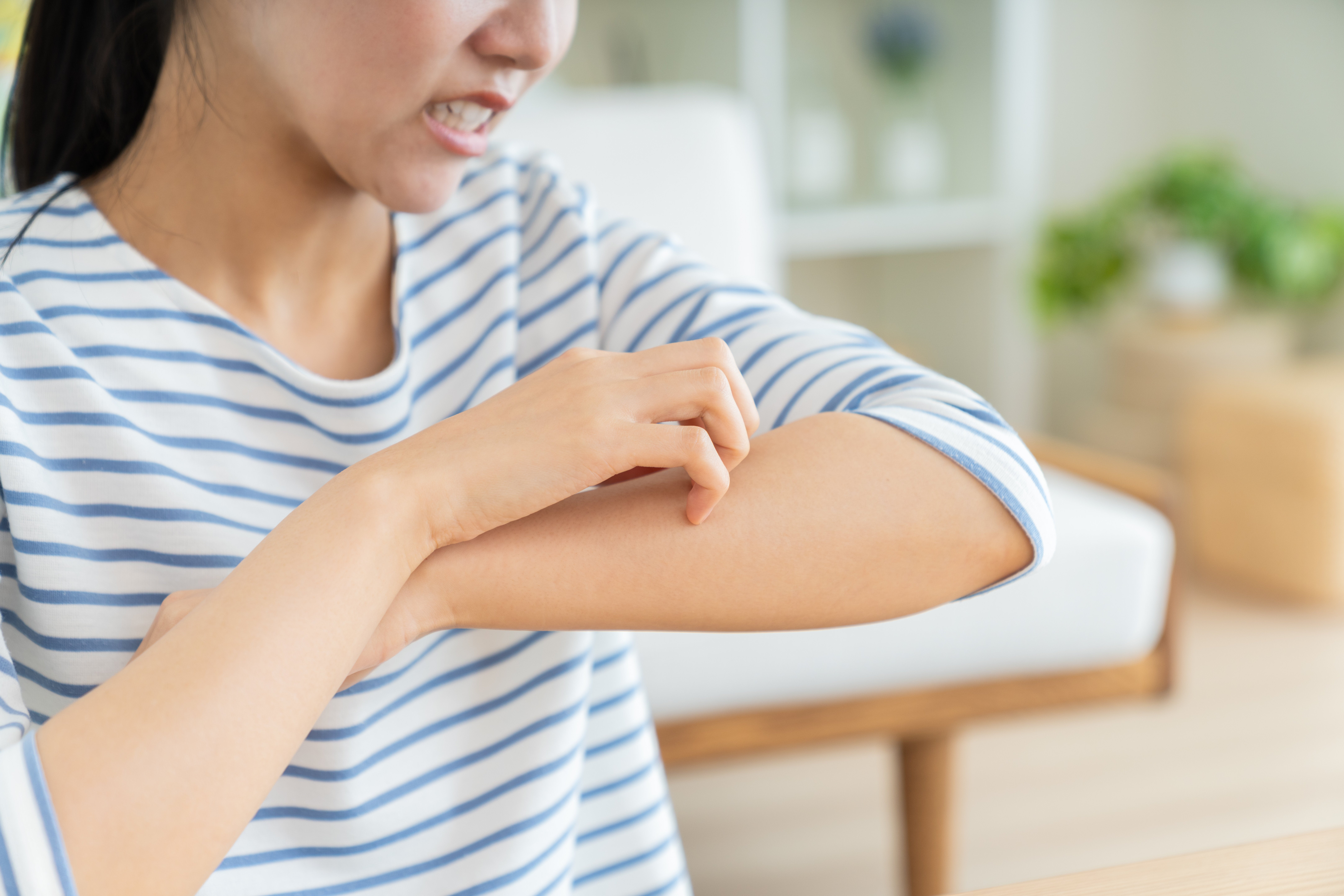 アリそっくりの黒い虫、絶対に触ったらダメ。6月に増える「ヤケドムシ」。SNSで“ミミズ腫れ”被害報告も