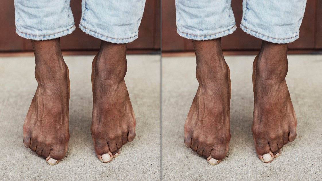 What Hair On Your Toes Says About Your Health, According To Doctors