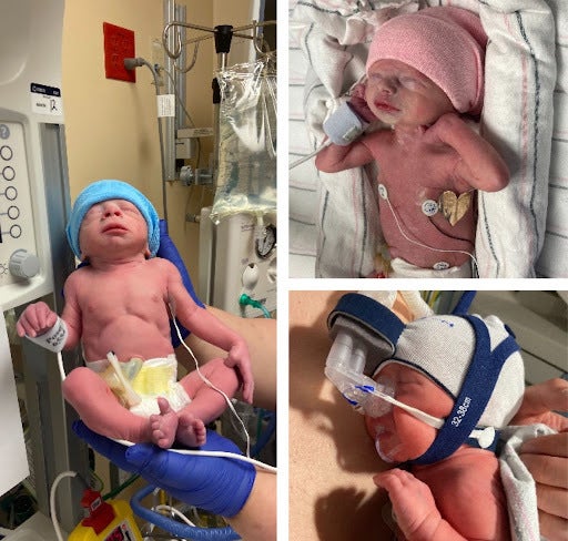 The author’s triplets, Albert (left), Charlee (top right), and Frankii (bottom right), as newborns at St. Vincent Hospital in Indianapolis.