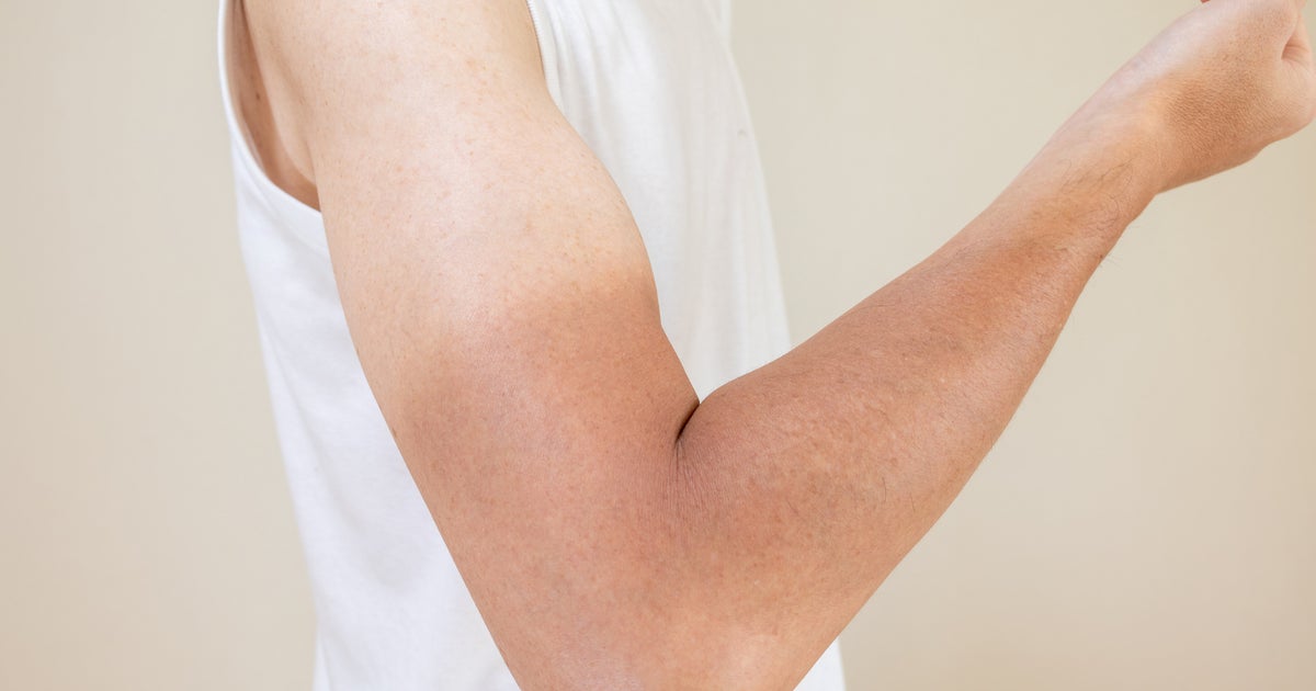 The Viral 'Tanmaxxing' Trend Is Exploding Online – And It’s Ruining Teen Skin