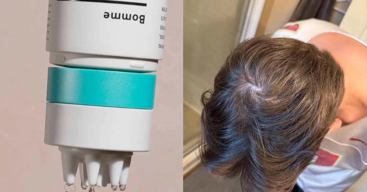 My Hair Was Noticeably Thinning — Until I Tried This K-Beauty Scalp Toner