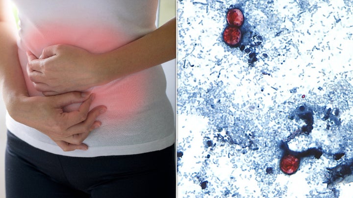 The difference between everyday diarrhea and cyclosporiasis could be in the length of symptoms.