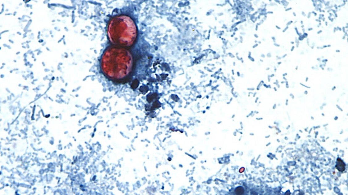 Taco Bell lettuce identified as source of cyclospora parasite outbreak