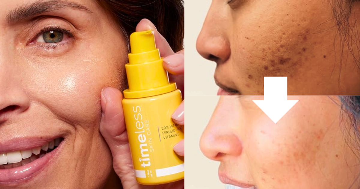 The Vitamin C Serum People Over 50 Adore For Wrinkles And Age Spots