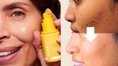 is vitamin c serum good for lips Does it really brighten dark lips?  Our Lip contains C, Peptide, and Squalane, which can help make your look healthier and softer!  Have you tried our Lip Introducing vitamin C mineral SPF 30 lip serum in four universal shades (Baby Pink Starting out with the strongest