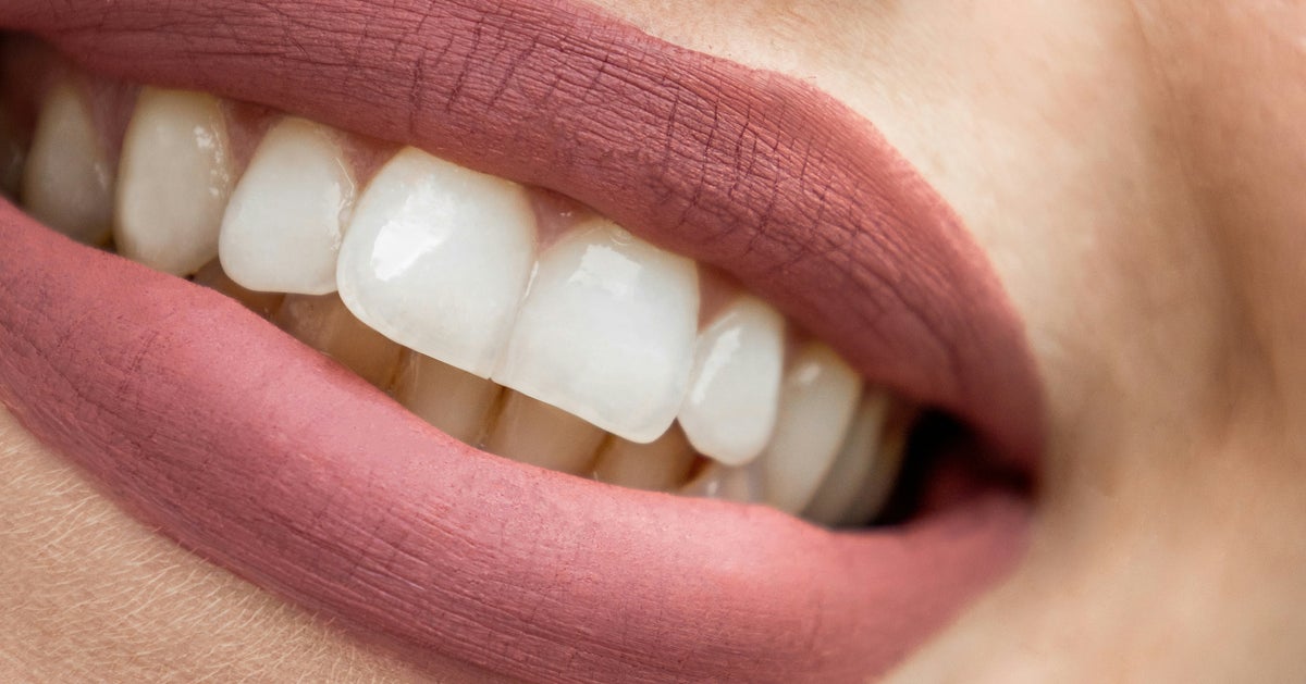Researchers Are 'Excited' About A Gel That May Regrow Tooth Enamel