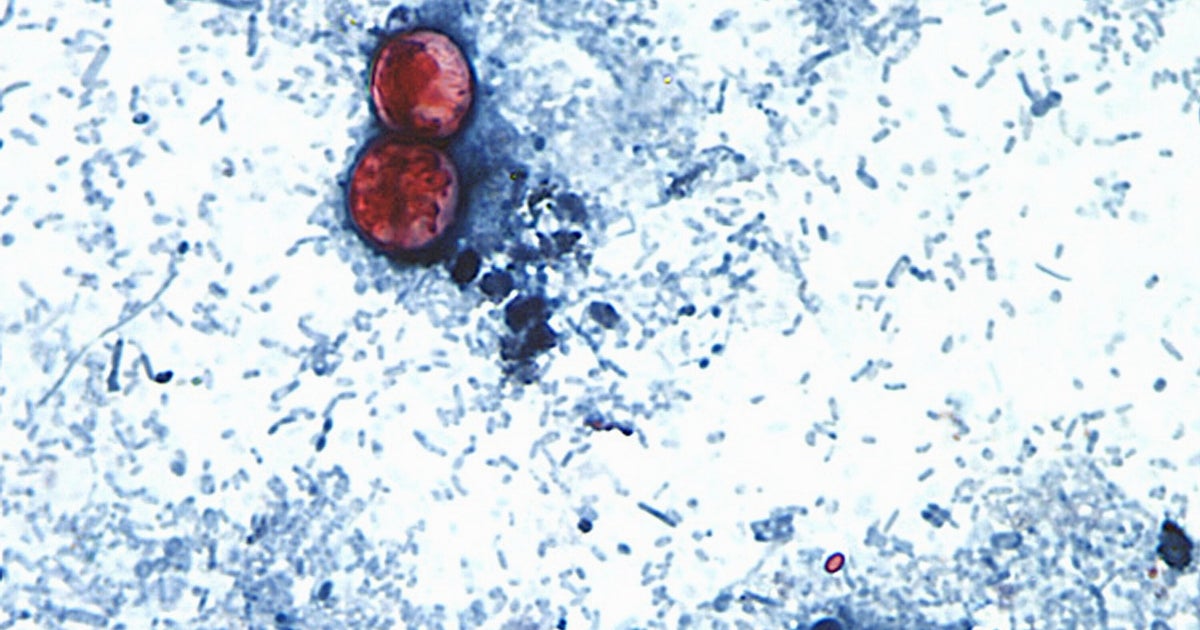https://img.huffingtonpost.com/asset/6a6507f6140000a3aceae98c.jpeg?cache=1mhfNzJSSJ&ops=1200_630