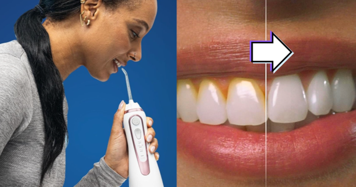 This 34% Off Water Flosser Is Going To ‘Save Me Thousands Of Dollars In A Dentist Chair!’