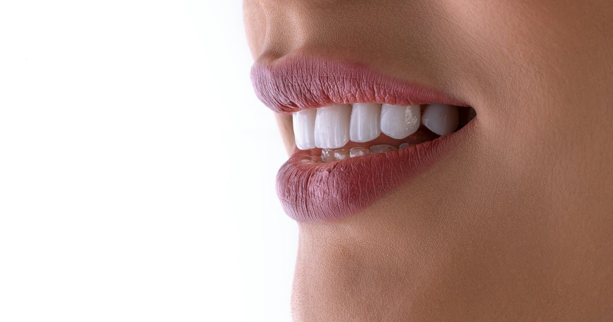 Oh Good – Now We Have To Worry About 'Heatwave Teeth'