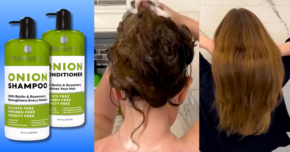 ‘As A 53-Year-Old Menopausal, GLP-1-Using Woman, I Was Losing Hair By The Handful’ — Until This $22 Buy