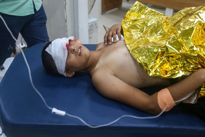 A child gets treated at Nasser Hospital for an injury sustained in an Israeli airstrike on a tent for displaced Palestinians, in Khan Younis on Aug. 16, 2026.
