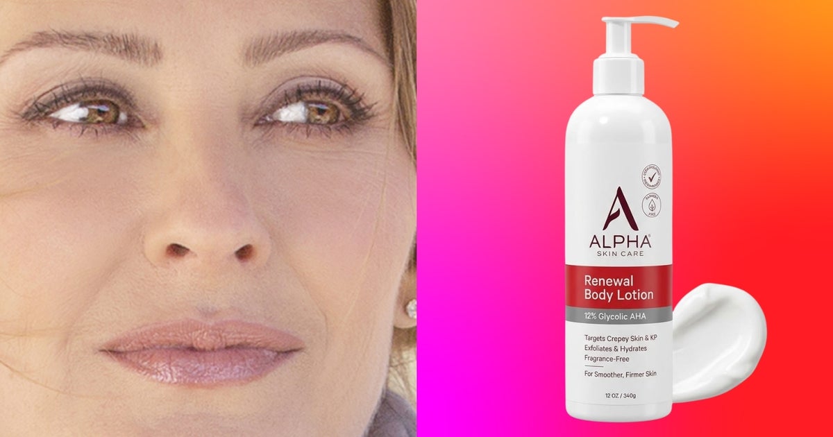 ‘My Skin Is Transformed’: This Under-$20 Retinol Body Lotion Takes Skin From Crepey To ‘Glowy And Soft’