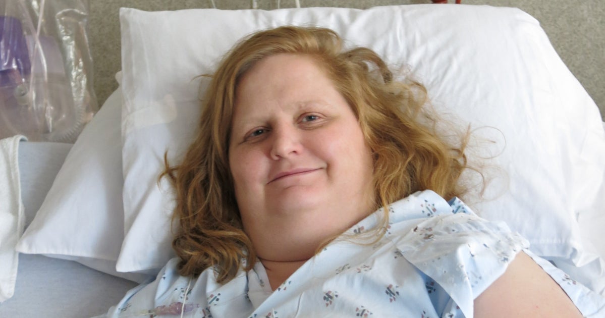 I Have A ‘Fat’ Disease That Doesn’t Respond To Diet Or Exercise ...