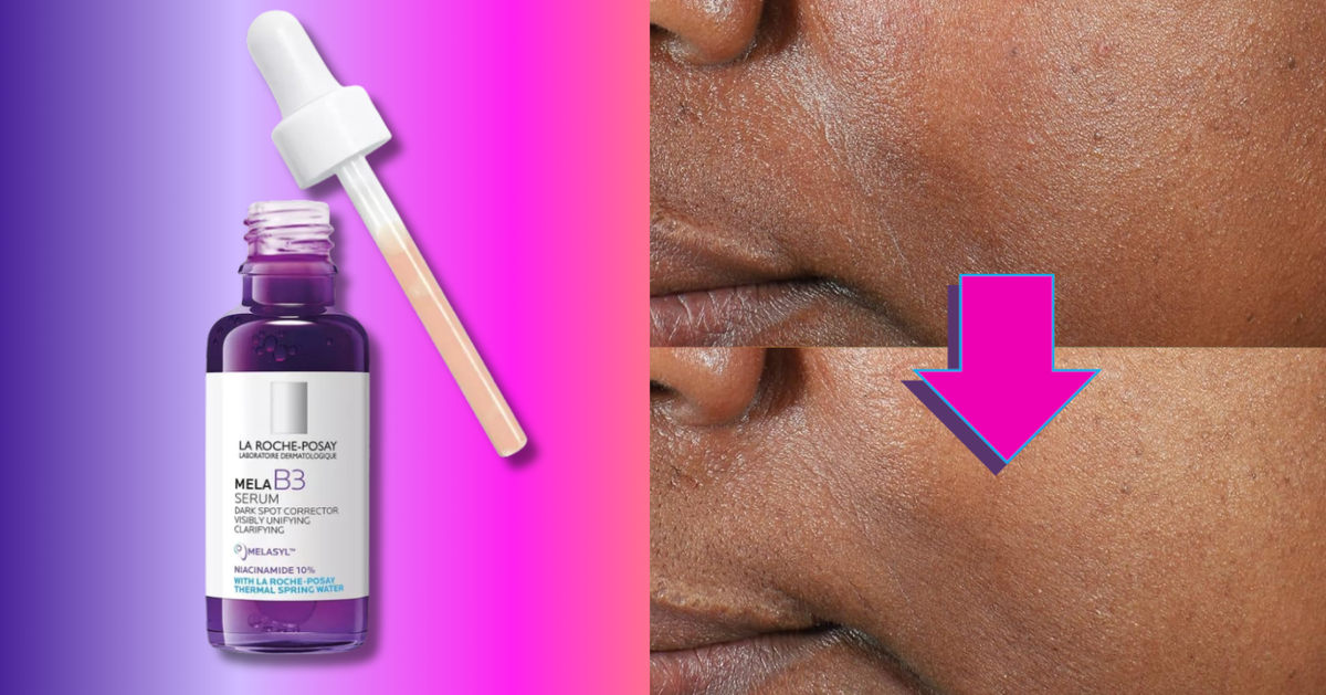 Sun Damage Can Leave Skin Looking Crepey. This Expert-Recommended Ingredient May Help
