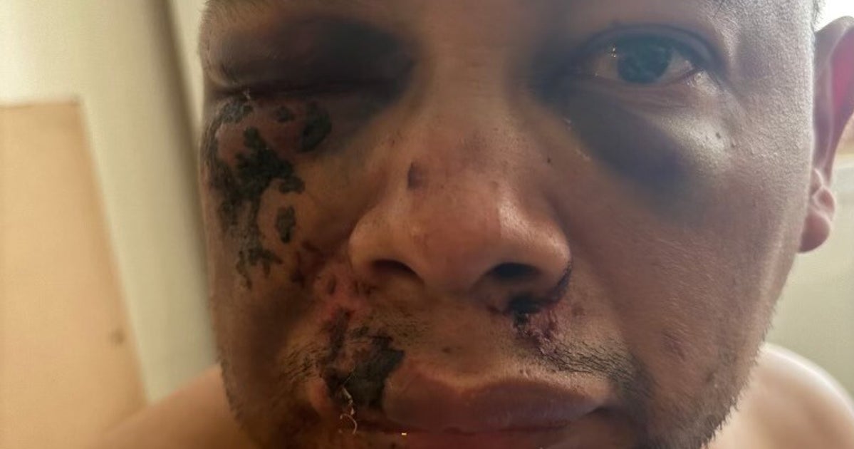 https://img.huffingtonpost.com/asset/6a91ad721900004acb6bba08.jpg?cache=XlY7yiIucO&ops=1200_630