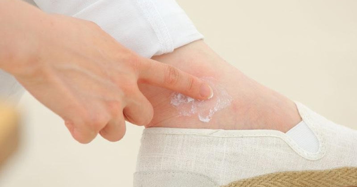 蚊に刺されにくくする対策4選を紹介。蚊を引き寄せるのは「あれ」だった