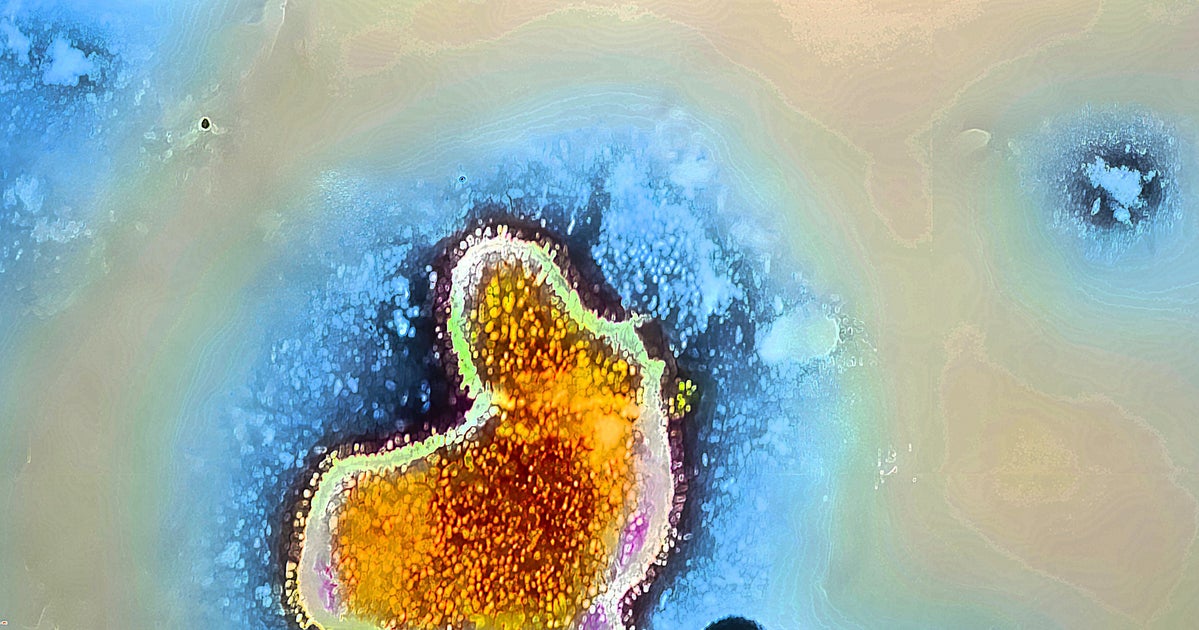 Photo: huffpost.com NC Teen Dies After Contracting Rare Brain-Eating Amoeba in Freshwater