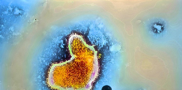 Naegleria fowleri, an amoeba that thrives in warm freshwater, can lead to a highly fatal brain infection if it enters one’s nose.