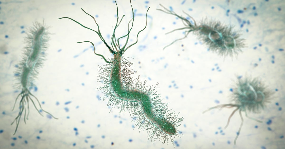 Common Stomach Bacteria Linked To 1 In 5 Bowel Cancer Cases In Global Analysis