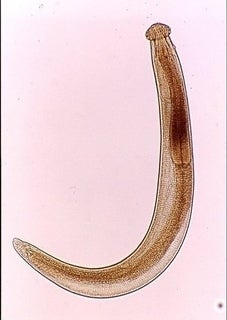 青森県が公開している寄生虫の写真