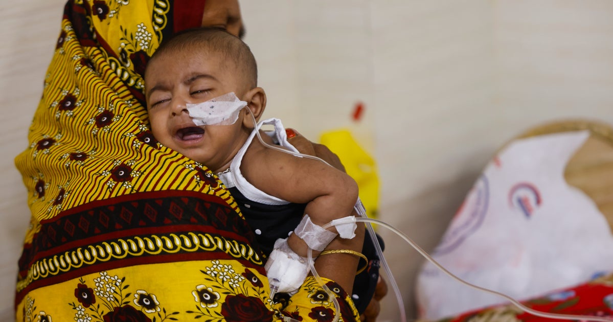 Suspected Measles Cases Kill Nearly 1,000 As Bangladesh Struggles To Contain Outbreak Suspected Measles Cases Kill Nearly 1,000 As Bangladesh Struggles To Contain Outbreak