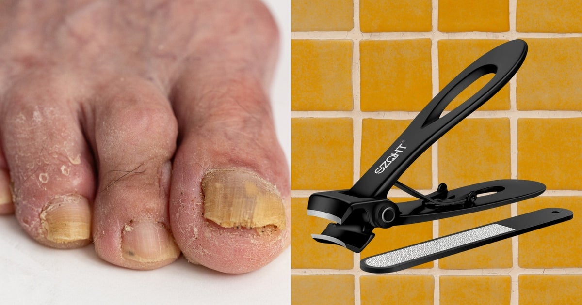 Yes, Your Toenails Get Harder To Cut With Age. Luckily, These Clippers Make It Easy.